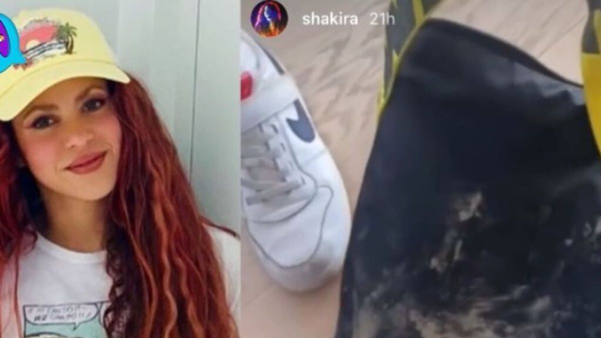 Shakira muestra los restos de su bolso tras ser atacada por dos jabalíes en Barcelona