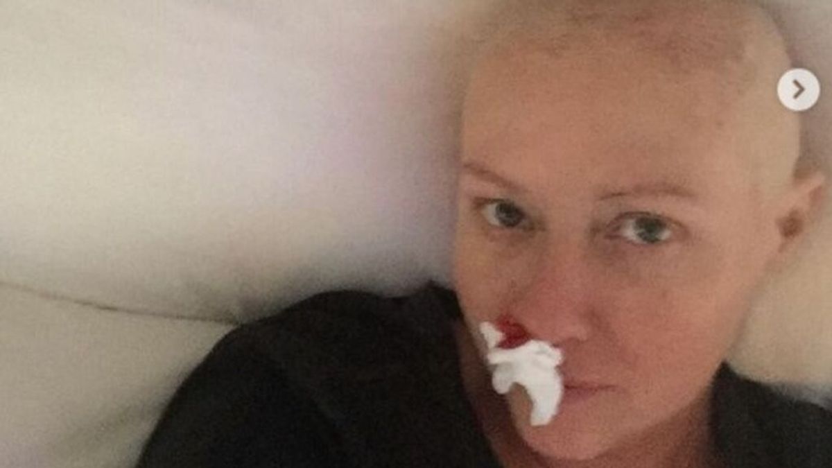 Shannen Doherty comparte sus imágenes más duras para concienciar sobre el cáncer