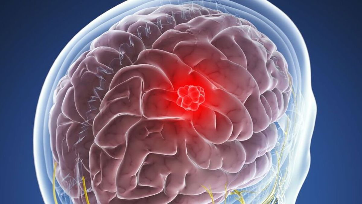 Una nueva terapia contra el cáncer elimina totalmente los tumores cerebrales en pacientes terminales