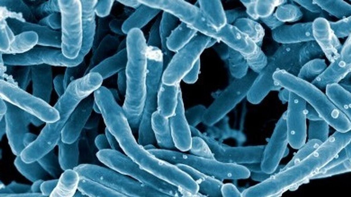 Las muertes por tuberculosis crecen por primera vez en más de una década a raíz de la covid