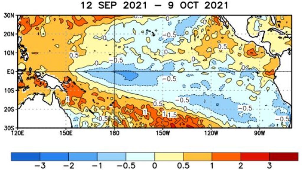 sst anomayç