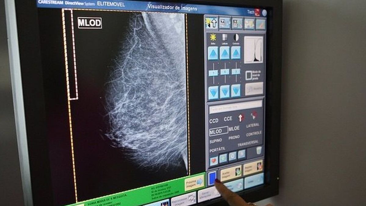 Osakidetza adquiere mamógrafos de última generación para mejorar la detección precoz del cáncer de mama Osakidetza adquiere mamógrafos de última generación para mejorar la detección precoz del cáncer de mama