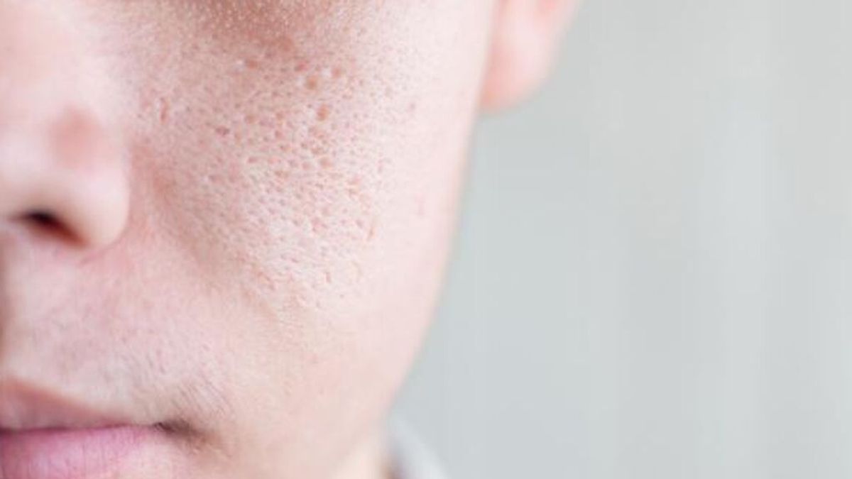 ¿Cómo cerrar los poros abiertos de la cara? Todo lo que debes saber para cuidar bien el rostro.