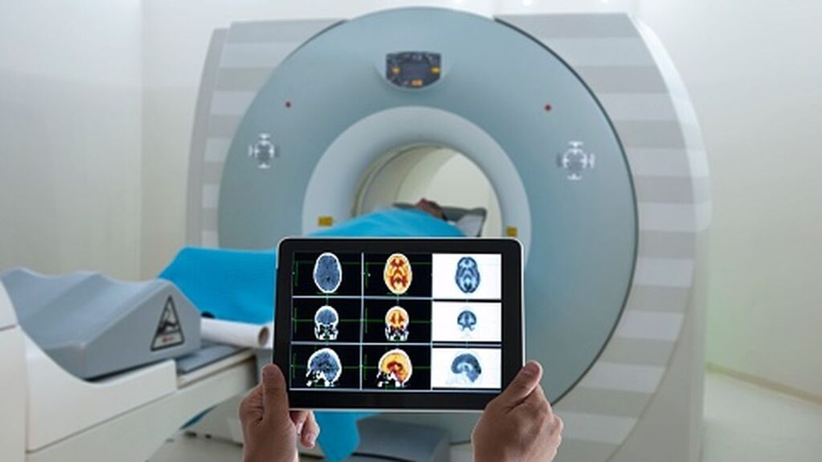 Nuevos mecanismos para mejorar la radioterapia y el diagnóstico del cáncer