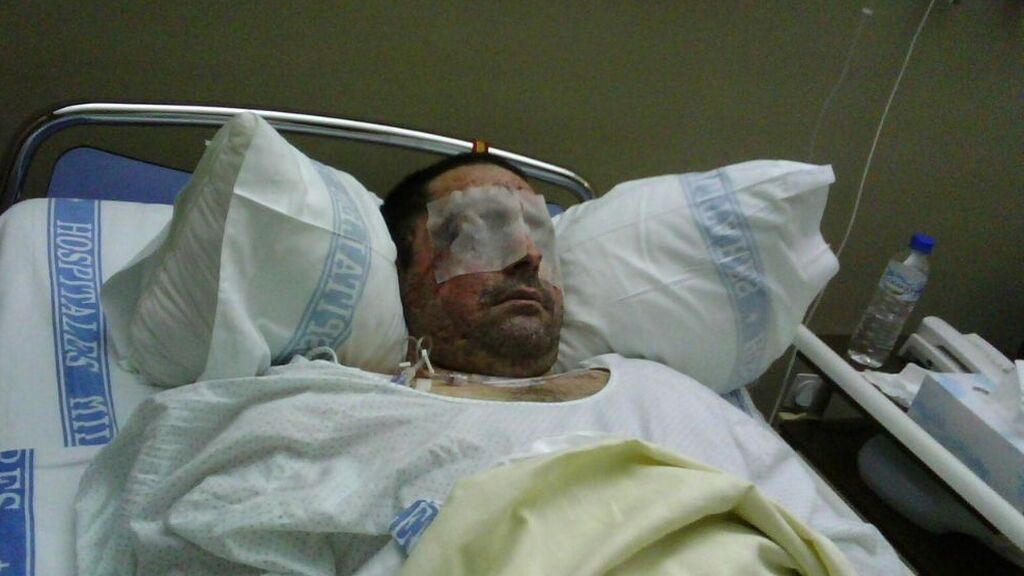 El teniente José Candón durante su ingreso tras el accidente militar de Hoyo de Manzanares el 24 de febrero de 2011.