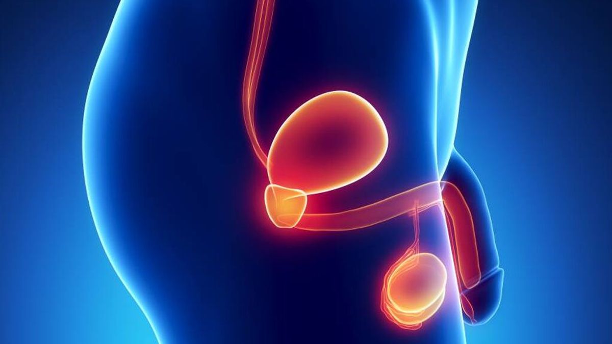 Cómo detectar los primeros síntomas de cáncer de próstata, testículos y pene, que también afecta a jóvenes