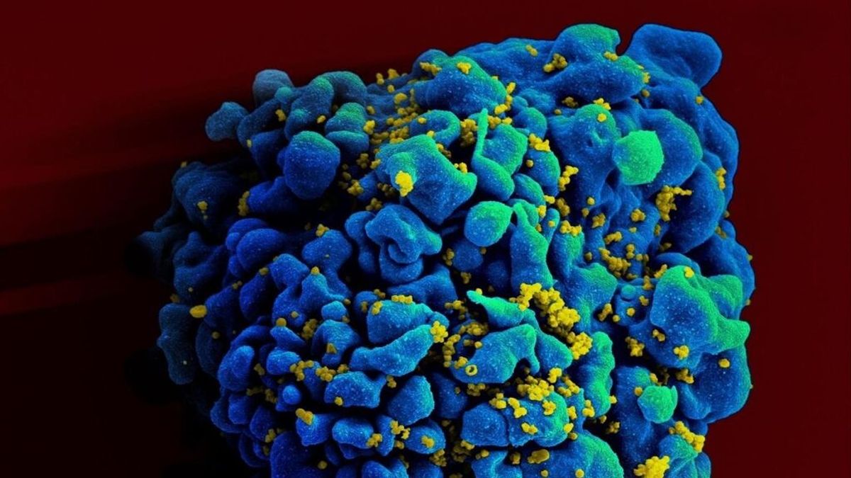 Identifican un segundo paciente con VIH no tratado cuyo cuerpo ha eliminado el virus Identifican un segundo paciente con VIH no tratado cuyo cuerpo ha eliminado el virus