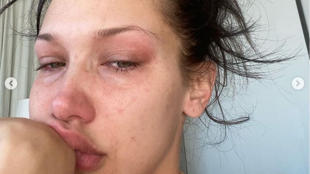 Bella Hadid se sincera sobre su depresión