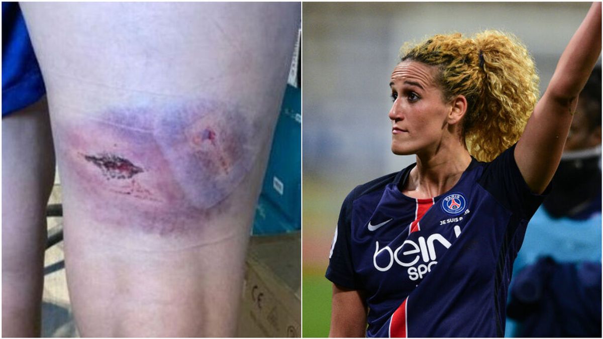 Hamraoui muestra las consecuencias de la brutal paliza que sufrió: "Traté de protegerme con las manos" Hamraoui muestra las consecuencias de la brutal paliza que sufrió: "Traté de protegerme con las manos"