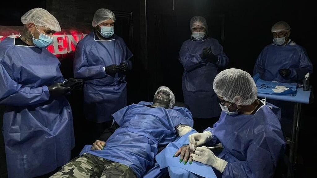 Anthony Loffredo, el 'alienígena negro', reaparece ahora con una 'garra' tras amputarse dos dedos