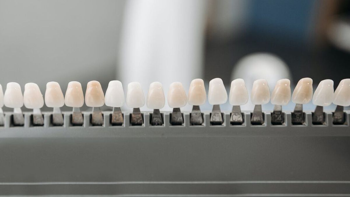 ¿Son seguros los kit caseros de blanqueamiento dental?
