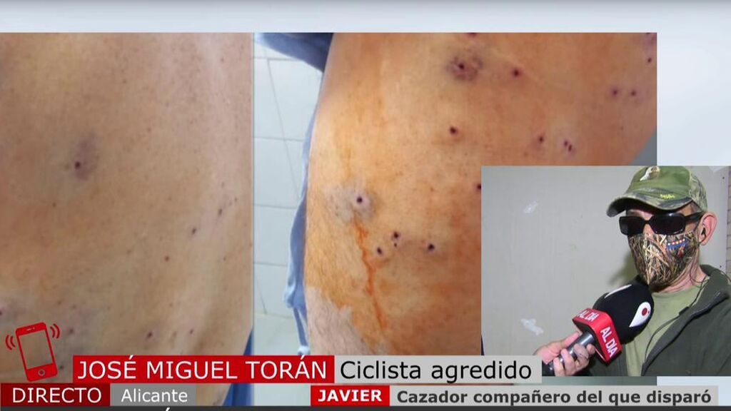 El ciclista que recibió más de cien perdigonazos tiende la mano al cazador que disparó: “Está traumatizado y en shock”