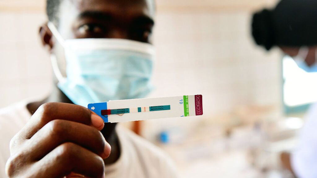 Día Mundial del Sida:  Una pandemia que sigue matando