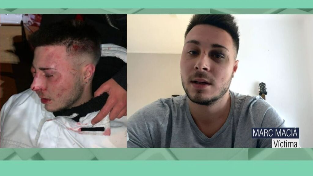 La última víctima de la discoteca de Sabadell: "Me pusieron bridas los porteros y me pisaron la cabeza"