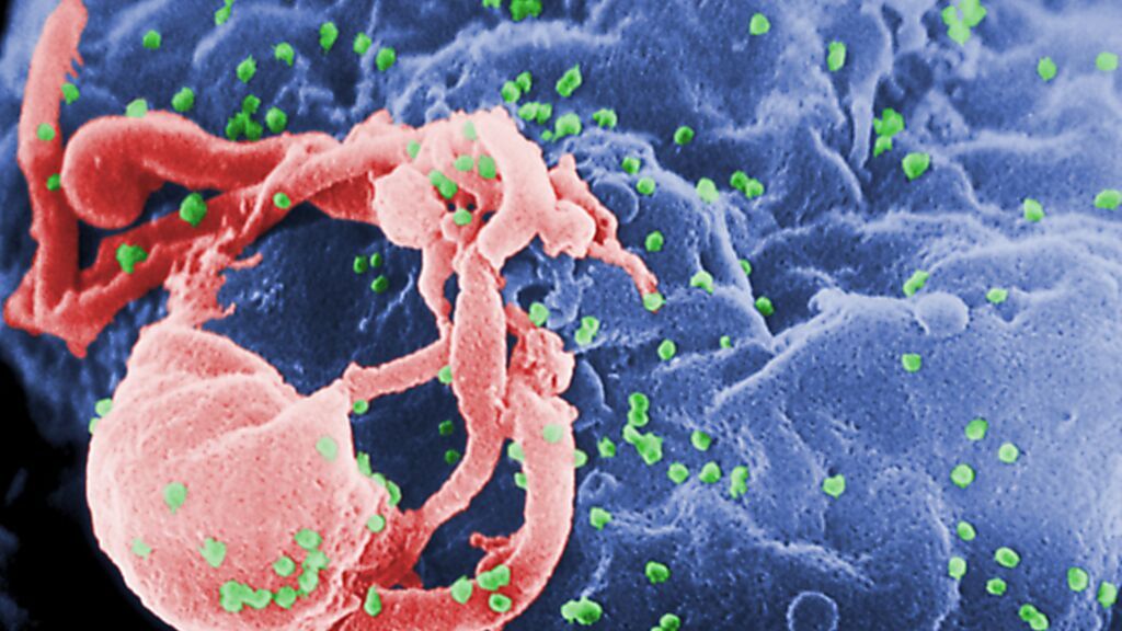 Viriones del VIH infectando un linfocito
