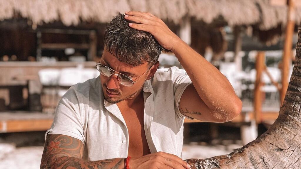 Cristian Jerez muestra el resultado de su injerto capilar