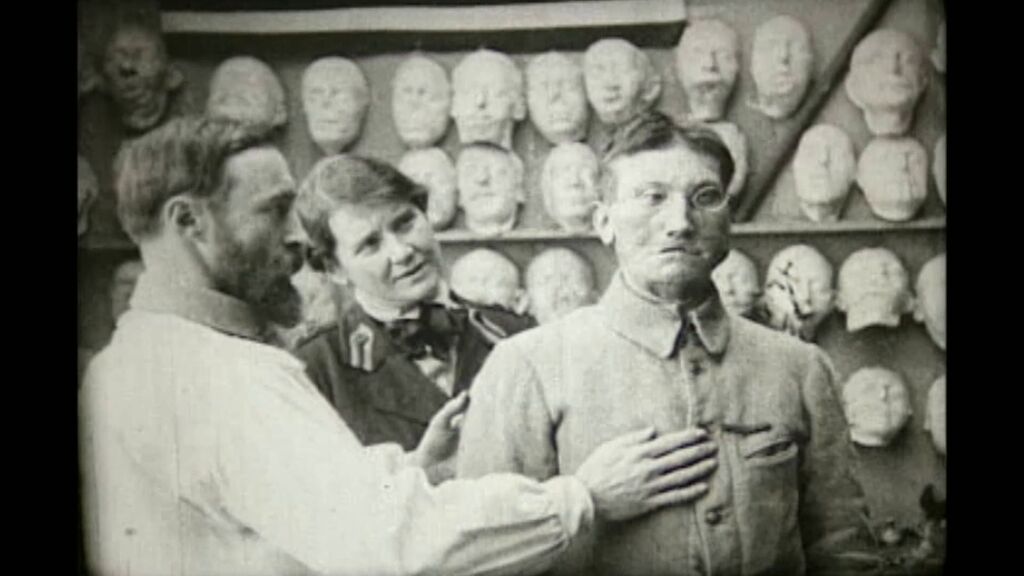 La triste historia de los 'caras rotas'