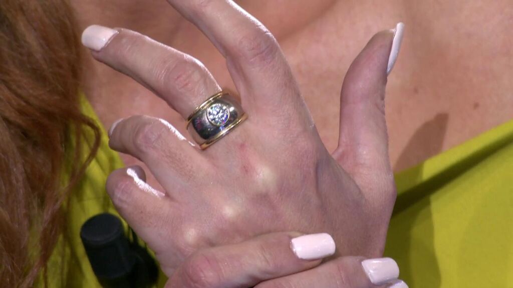 Rocío lleva desde hace 15 años este anillo de su madre