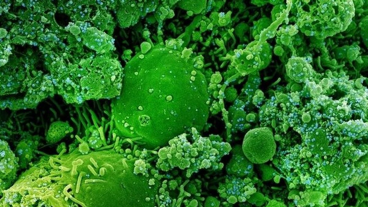 Identificados anticuerpos que neutralizan ómicron y que serán clave para desarrollar nuevos tratamientos Identificados anticuerpos que neutralizan ómicron y que serán clave para desarrollar nuevos tratamientos