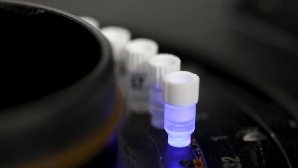 Detectan una nueva variante del coronavirus con 46 mutaciones en Francia