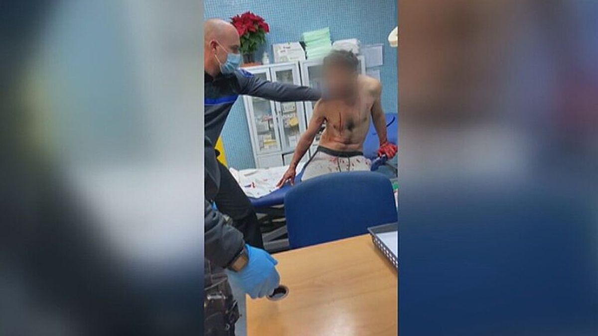Investigan si un hombre que se autolesionaba y lamía la sangre estaba bajo el efecto de la 'droga caníbal' Investigan si un hombre que se autolesionaba y lamía la sangre estaba bajo el efecto de la 'droga caníbal'