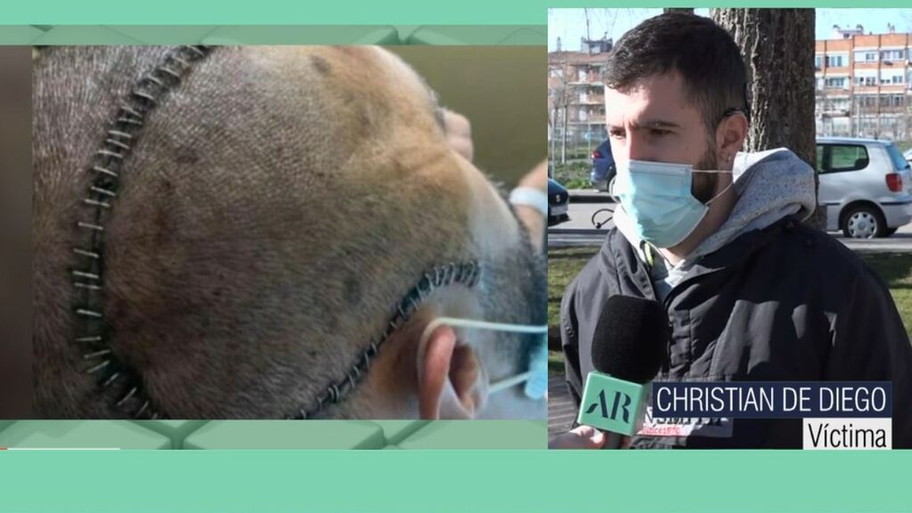 El militar de Huesca, tras la paliza: "Mi cerebro no empezó a funcionar hasta que me operaron y estaba en la UCI"