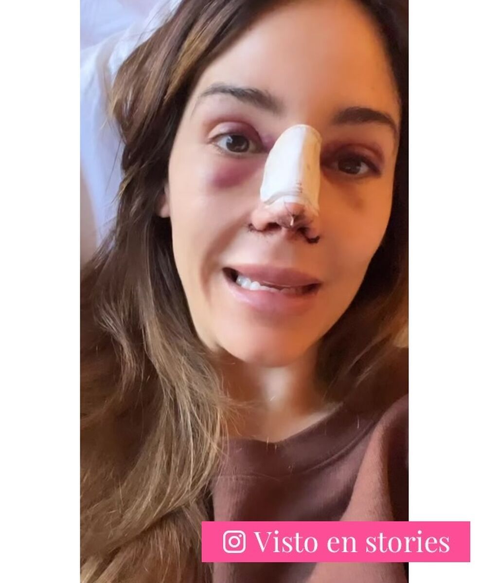 La primera imagen de Rocío Osorno tras haberse operado la nariz