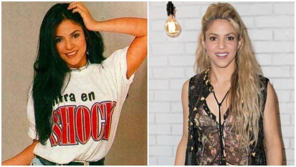 La forma de la cara de Shakira también ha cambiado mucho en los últimos tiempos.