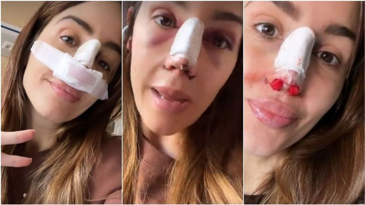 Rocío Osorno pasa por quirófano para operarse la nariz: “Me ahogaba mucho”