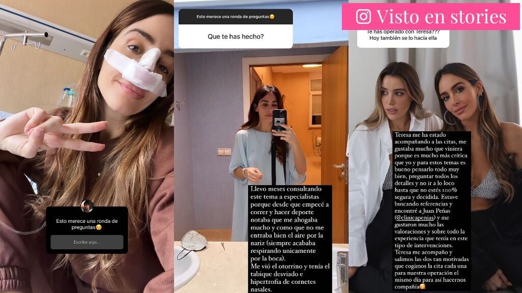 Rocío Osorno explica los detalles de su operación de nariz