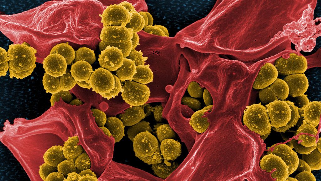Las bacterias resistentes a antibióticos matan a 1,2 millones de personas, más que el VIH o la malaria