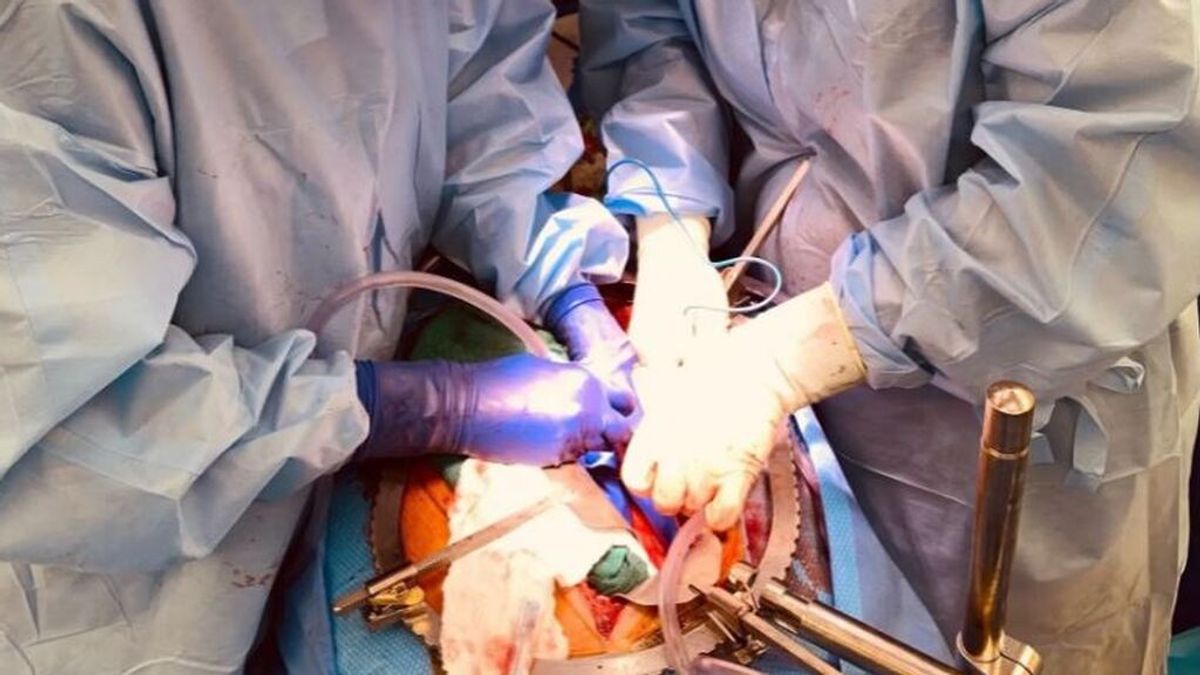 Un hombre en EE.UU. recibe por primera vez dos riñones de cerdo modificados genéticamente Un hombre en EE.UU. recibe por primera vez dos riñones de cerdo modificados genéticamente
