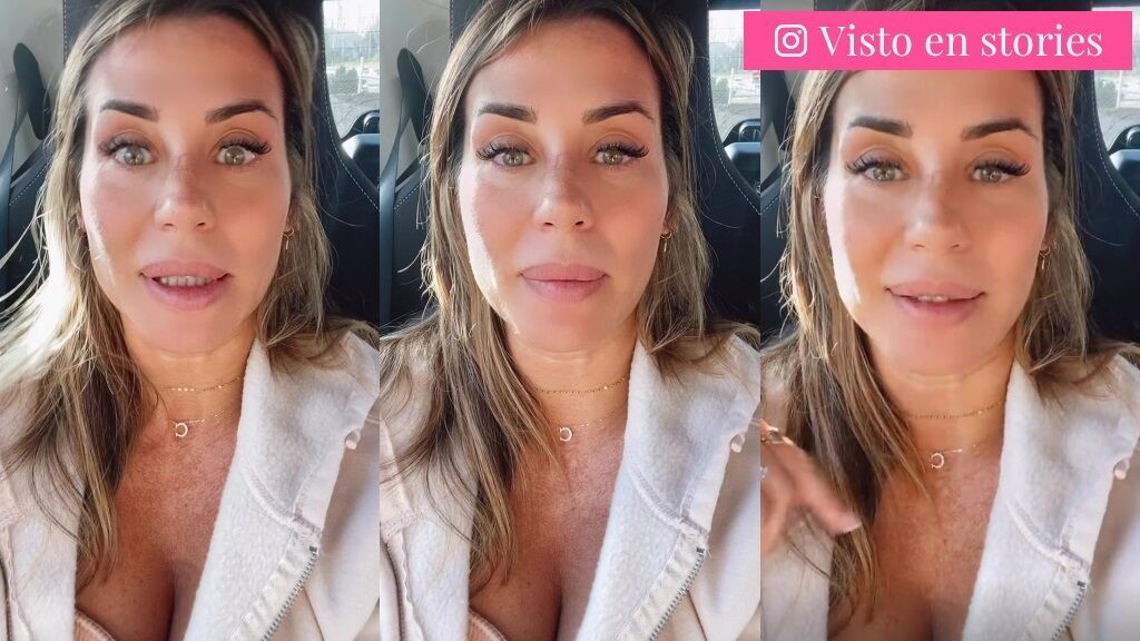 Elena Tablada muestras las manchas que tiene casi dos años después de dar a luz