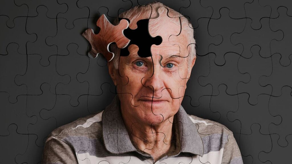 Neurólogos ponen en duda los estudios que relacionan covid y Alzheimer