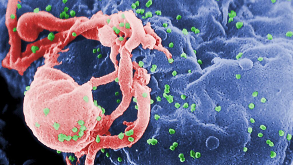 Por qué aparece una variante más virulenta del virus del sida