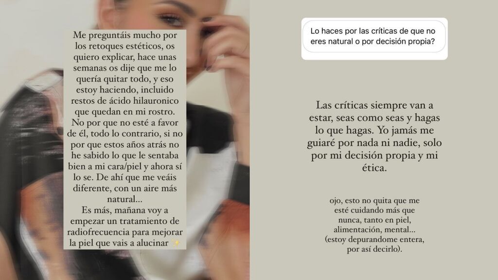 marina garcia retoques