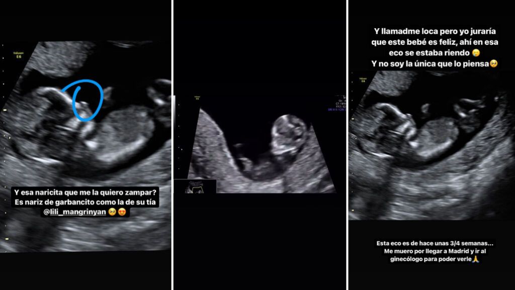 Violeta ha presentado a su bebé en varias ecografías