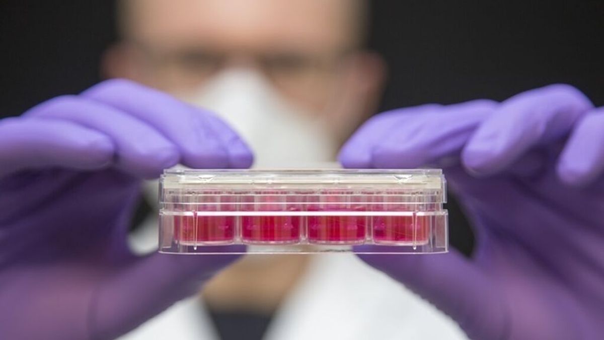 ¿Cómo las células madres combaten el VIH? Médicos anuncian la primera curación de una mujer con VIH
