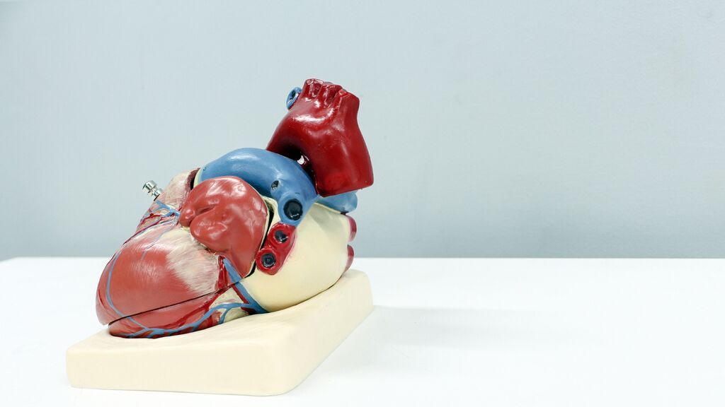 infarto