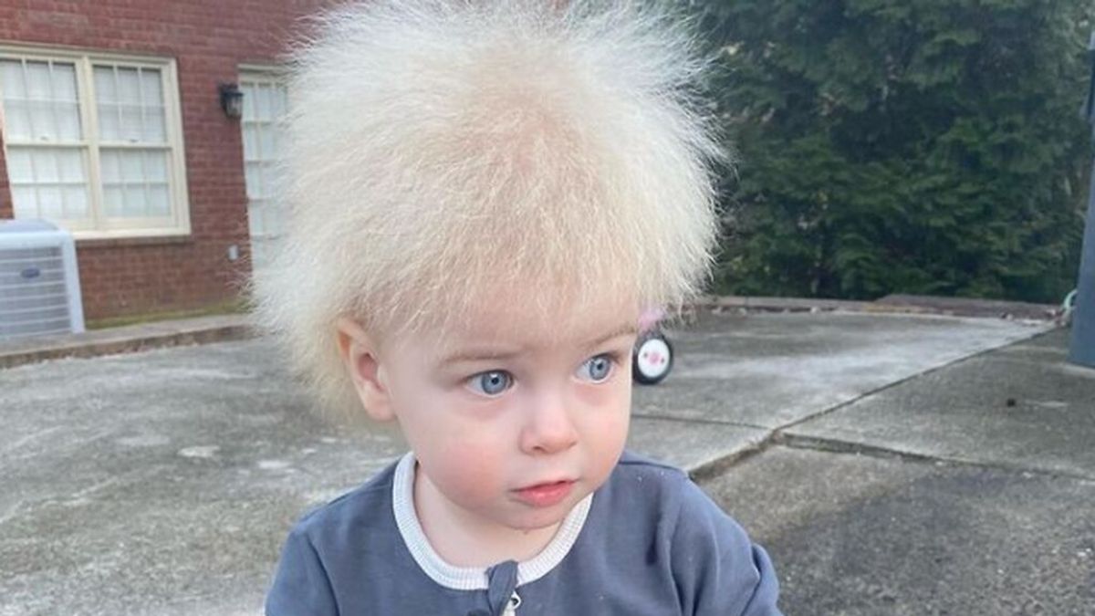 Un niño pequeño diagnosticado con el raro síndrome del cabello que no se puede peinar