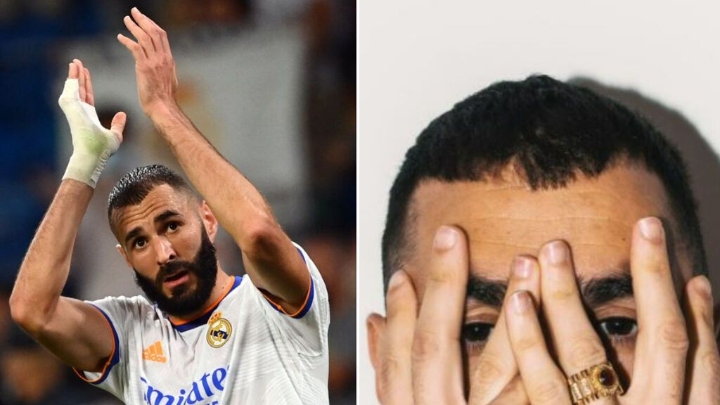 Benzema vuelve a mostrar su dedo meñique sin vendaje: sigue sin querer operarse