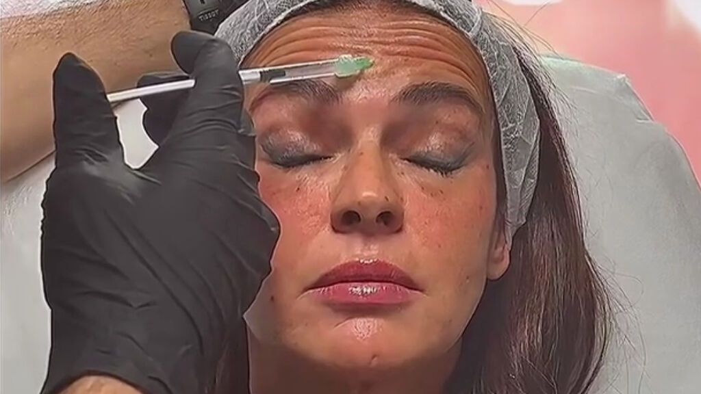 Olga Moreno se somete a varios retoques estéticos en el rostro