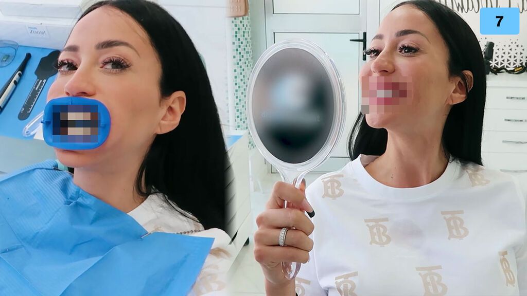 Aurah Ruiz se realiza un diseño de sonrisa antes de su boda con Jesé (2/2)