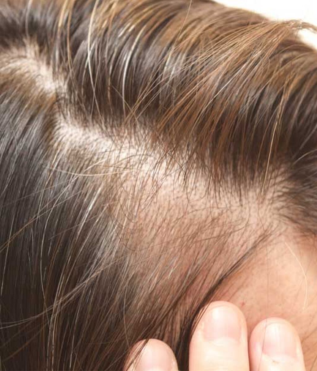 Ayuda a tu cabello a prevenir la caída en primavera