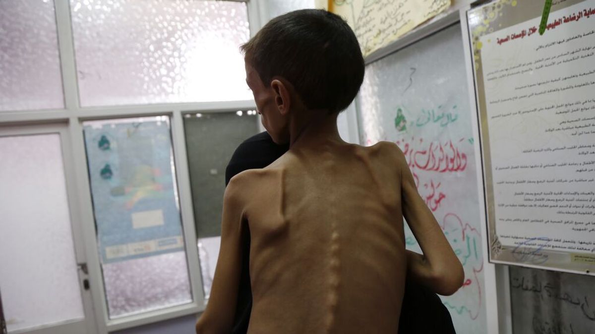 Más de 10.200 niños han muerto o resultado heridos a causa de la guerra en Yemen, según UNICEF