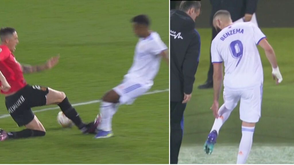 Benzema, lesionado en Son Moix