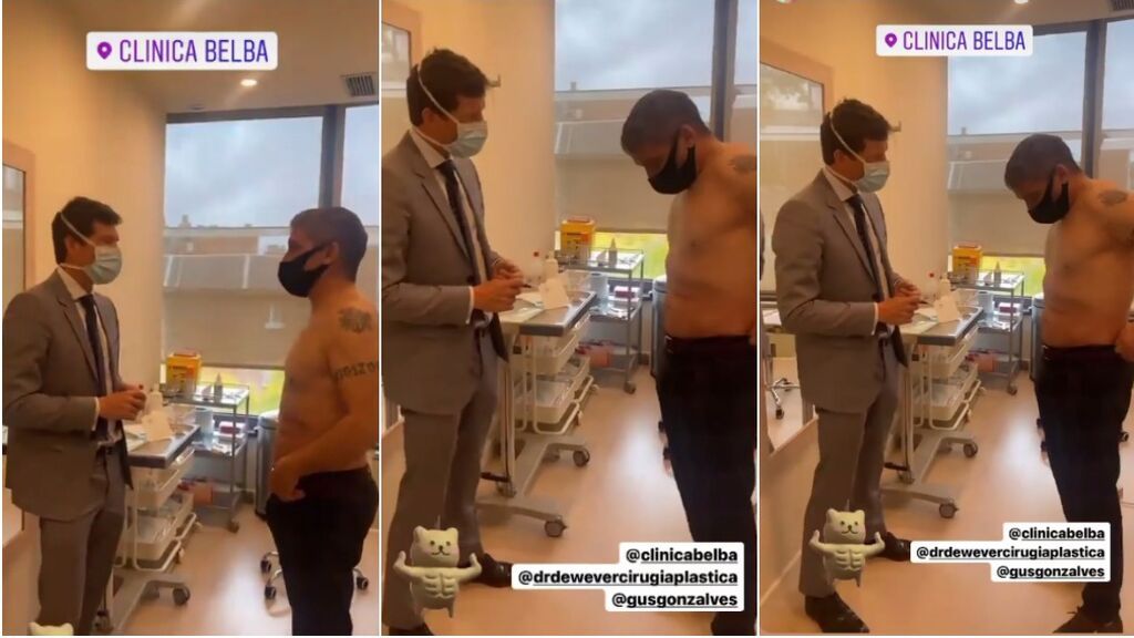 Gustavo González presume de abdominales tras su paso por quirófano