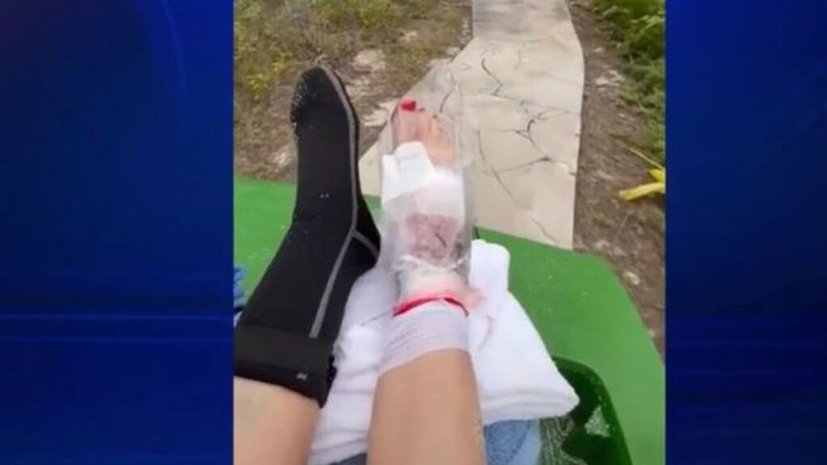 Una mujer relata cómo sobrevivió al ataque de un tiburón: estuvo a punto de perder el pie derecho de un mordisco