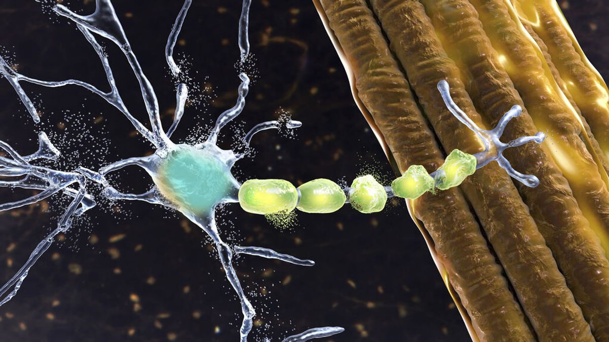 El futuro de la ELA pasa por los implantes, electrodos y señales eléctricas cerebrales para comunicarse El futuro de la ELA pasa por los implantes, electrodos y señales eléctricas cerebrales para comunicarse