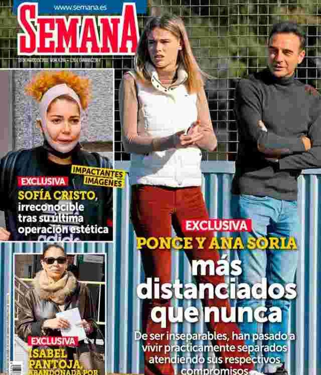Sofía Cristo, tras su operación estética